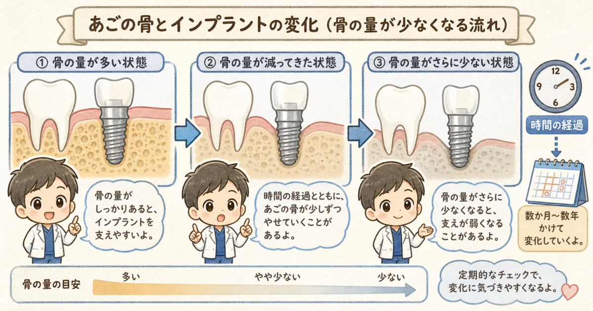 痛みが軽度でも進行する?インプラント周囲炎の初期症状とセルフチェック