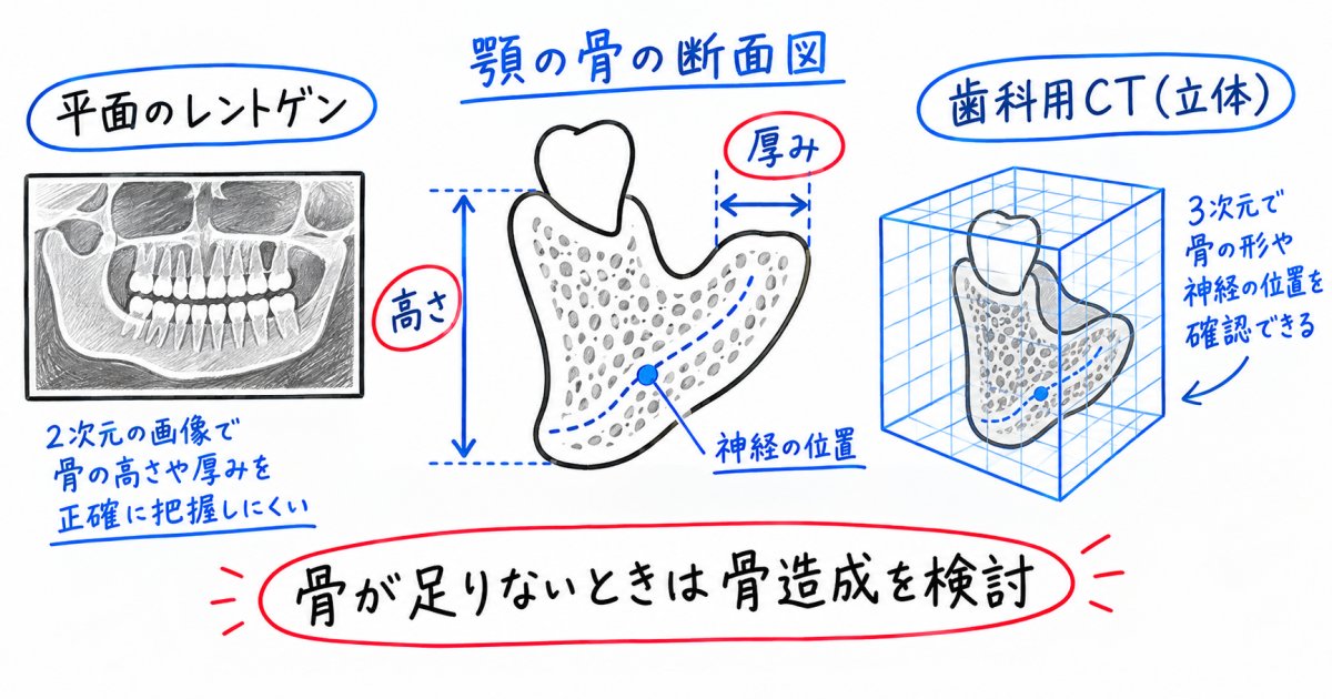 CT検査で分かる骨の状態と見極め方
