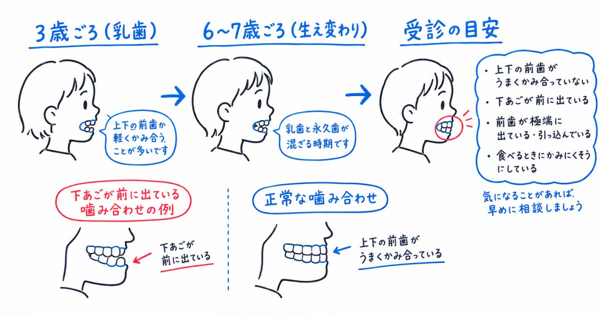 3歳児の受け口は自然に治る?年齢別の受診タイミングを解説