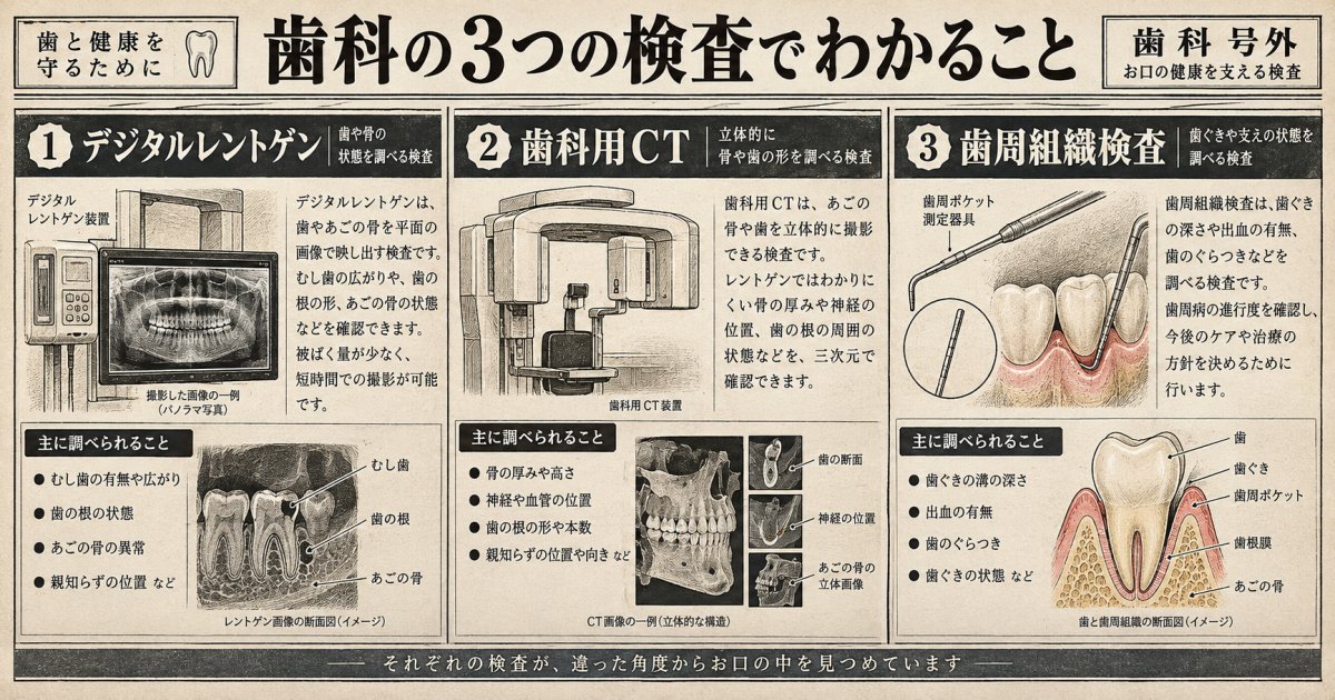 歯を残せるかは検査で何を確かめる？デジタルレントゲン・歯科用CT・歯周組織検査の役割